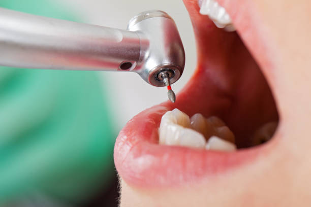 Best Emergency Tooth Extraction in Williamstown, NJ